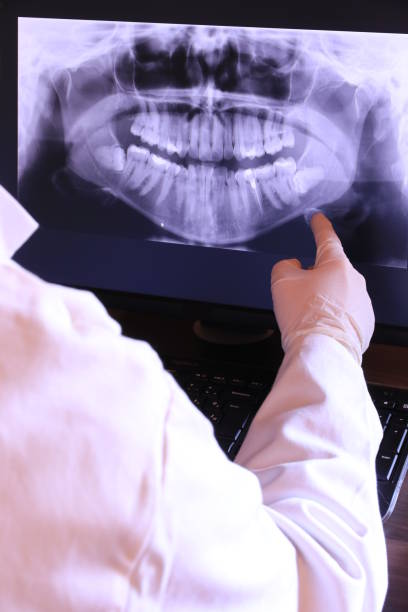 Best Emergency Dental Care for Broken or Chipped Teeth in Montalvin Manor, CA